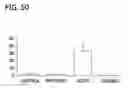 Fig. 49 - Quantitative differentiation of tumor heterogeneity using diffusion MR imaging data