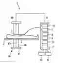 Fig. 01 - Blood flow determination apparatus