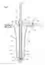 Fig. 06 - Guidance system mounts for surgical introducers