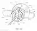 Fig. 08 - Flexible anchor delivery system