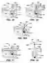 Fig. 06 - Surgical filament snare assemblies
