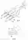 Fig. 09 - Hair grasping device