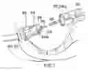 Fig. 07 - Surgical string applicator for anastomosis surgery