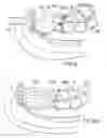 Fig. 08 - Surgical string applicator for anastomosis surgery