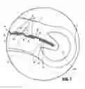 Fig. 06 - LIGATION CLIP WITH TISSUE RETENTION FEATURES