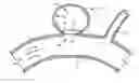 Fig. 01 - System for and method of treating aneurysms