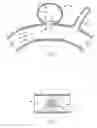 Fig. 02 - System for and method of treating aneurysms
