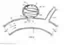 Fig. 06 - System for and method of treating aneurysms