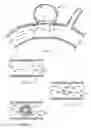 Fig. 09 - System for and method of treating aneurysms