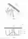 Fig. 07 - Left atrial appendage occluder