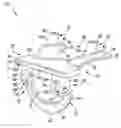 Fig. 01 - Customized patient-specific anterior-posterior chamfer block and method