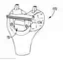 Fig. 01 - Method of designing and manufacturing low-profile customized patient-specific orthopaedic surgical instruments