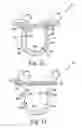 Fig. 22 - Method of designing and manufacturing low-profile customized patient-specific orthopaedic surgical instruments