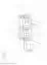 Fig. 03 - Electric motor driven tool for orthopedic impacting