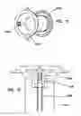 Fig. 22 - Natural orifice surgery system