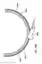 Fig. 33 - Natural orifice surgery system