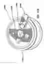 Fig. 40 - Natural orifice surgery system