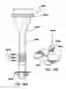 Fig. 46 - Natural orifice surgery system