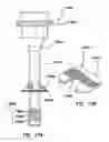 Fig. 47 - Natural orifice surgery system
