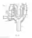 Fig. 04 - Trocar seal with retraction induced image