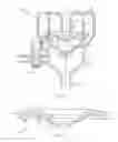 Fig. 07 - Trocar seal with retraction induced image