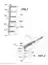 Fig. 02 - Orthopedic fixation screw with bioresorbable layer