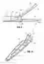 Fig. 07 - VESSEL SEALER AND DIVIDER FOR USE WITH SMALL TROCARS AND CANNULAS