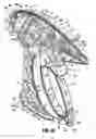 Fig. 09 - VESSEL SEALER AND DIVIDER FOR USE WITH SMALL TROCARS AND CANNULAS