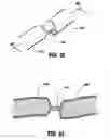 Fig. 22 - VESSEL SEALER AND DIVIDER FOR USE WITH SMALL TROCARS AND CANNULAS