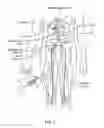 Fig. 08 - MULTIELECTRODE CATHETER
