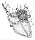 Fig. 01 - Apparatus and method for intra-cardiac mapping and ablation