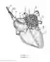 Fig. 02 - Apparatus and method for intra-cardiac mapping and ablation