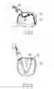 Fig. 08 - Apparatus and method for intra-cardiac mapping and ablation