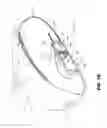 Fig. 04 - Tissue expanders, implants, and methods of use