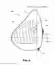 Fig. 09 - Tissue expanders, implants, and methods of use