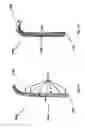 Fig. 40 - ENDOSCOPIC DEVICE WITH HELICAL LUMEN DESIGN
