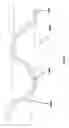Fig. 41 - ENDOSCOPIC DEVICE WITH HELICAL LUMEN DESIGN