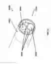 Fig. 45 - ENDOSCOPIC DEVICE WITH HELICAL LUMEN DESIGN