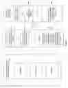 Fig. 02 - Methods and systems for employing artificial intelligence in automated orthodontic diagnosis and treatment planning