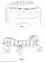 Fig. 07 - Dental alignment system and method for dental implant placement