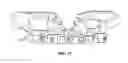Fig. 09 - Dental alignment system and method for dental implant placement