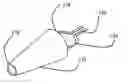 Fig. 01 - Tissue holding apparatus