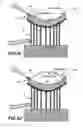 Fig. 05 - Tissue holding apparatus