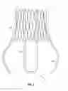 Fig. 02 - Docking Device for Aortic Valve Replacement
