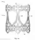 Fig. 02 - Collapsible prosthetic heart valves