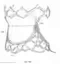 Fig. 06 - Collapsible prosthetic heart valves