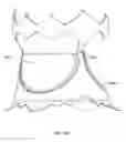Fig. 07 - Collapsible prosthetic heart valves