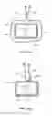 Fig. 22 - Collapsible prosthetic heart valves