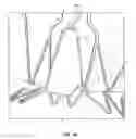 Fig. 44 - Collapsible prosthetic heart valves