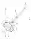 Fig. 02 - Delivery system and method for loading a self-expanding collapsible heart valve